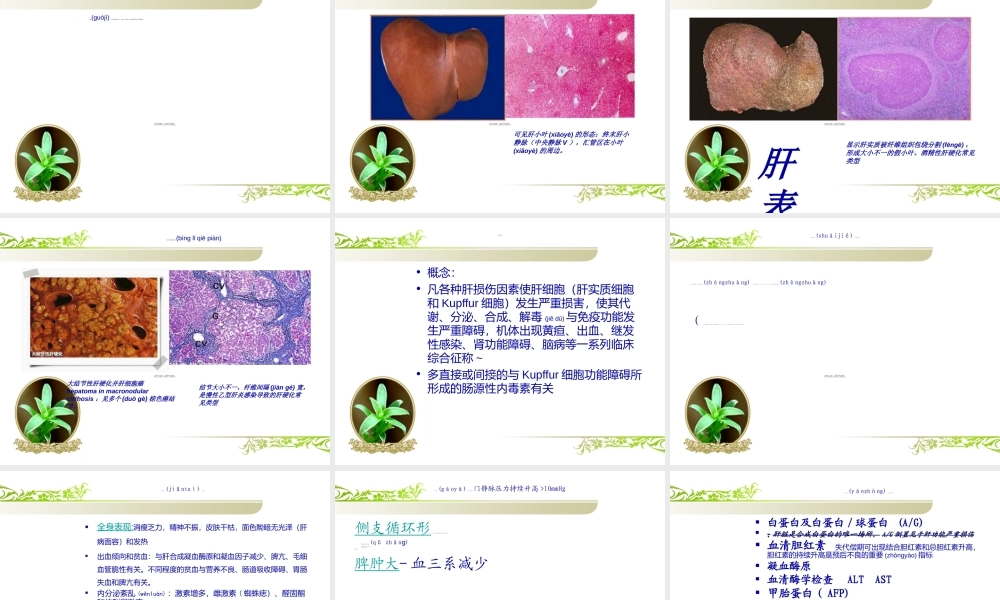 2022年医学专题—肝硬化-上消化道出血PPT(1).ppt