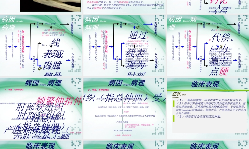 2022年医学专题—肱骨外上髁炎(4.4)(1).ppt