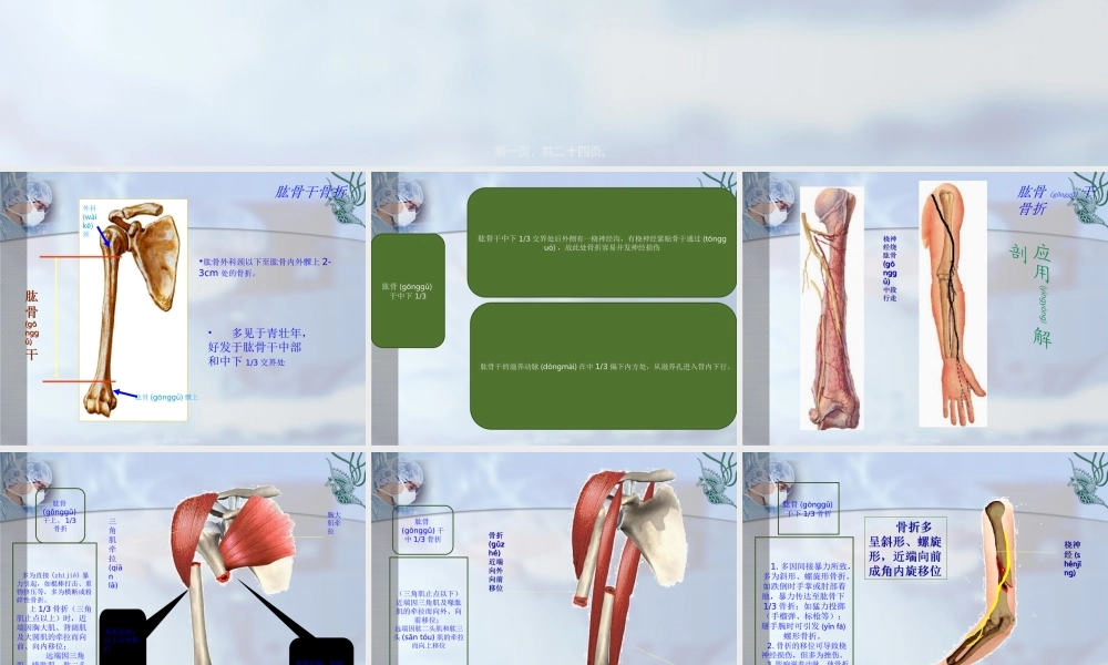 2022年医学专题—肱骨干骨折(1).ppt