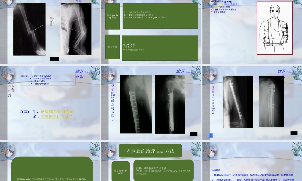 2022年医学专题—肱骨干骨折(1).ppt