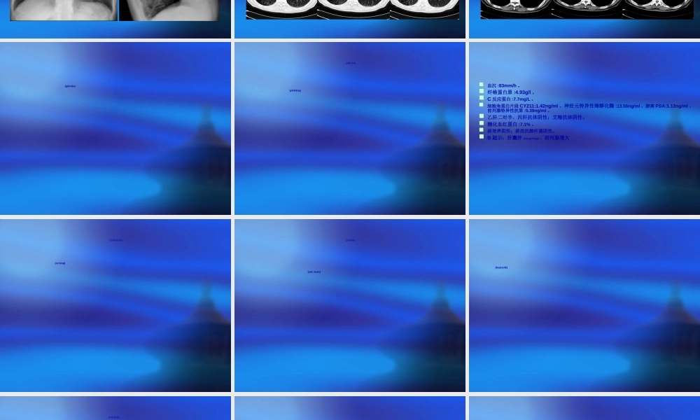 2022年医学专题—肺炎？支气管结石(1).ppt