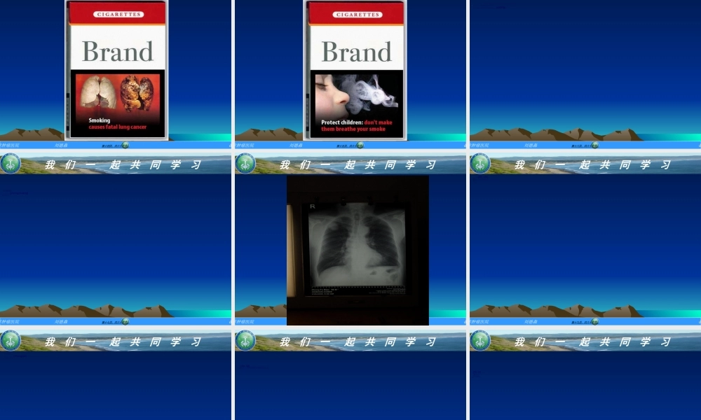 2022年医学专题—肺癌基本知识(1).ppt