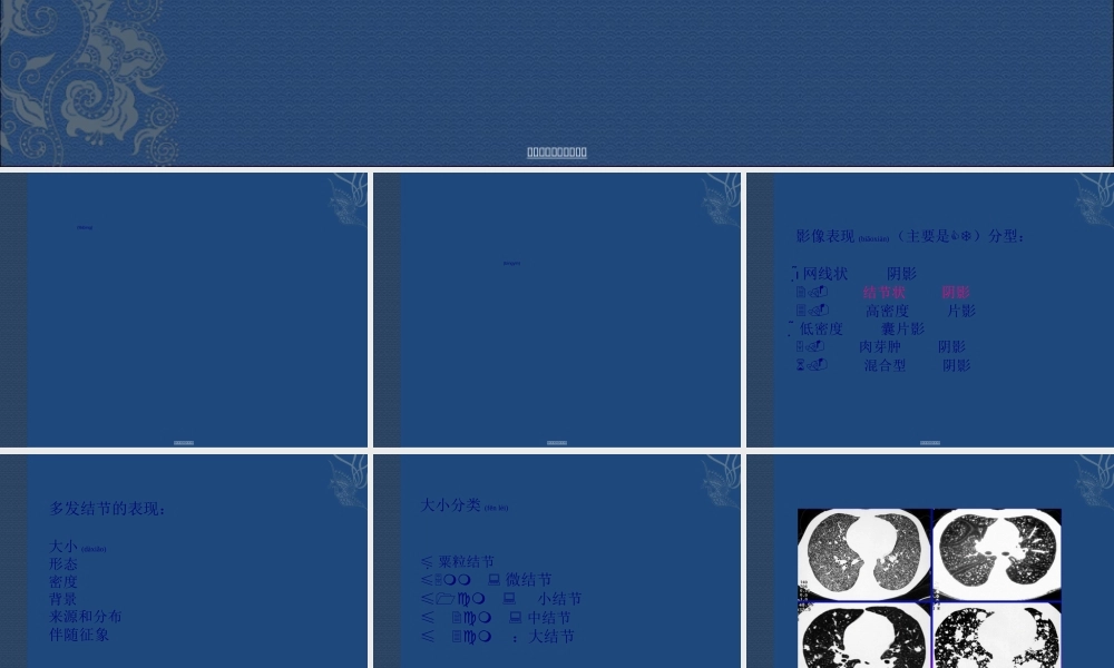 2022年医学专题—肺结节(1).ppt