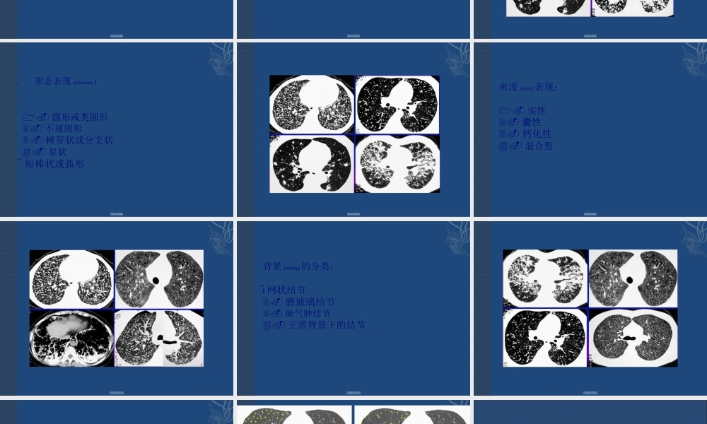 2022年医学专题—肺结节(1).ppt