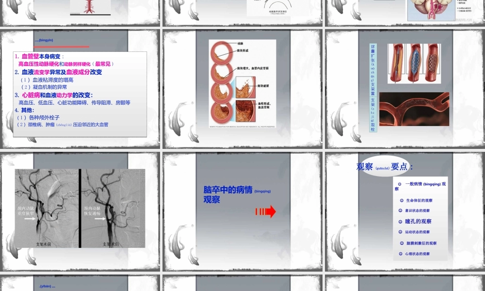 2022年医学专题—脑卒中患者的病情观察(1).ppt