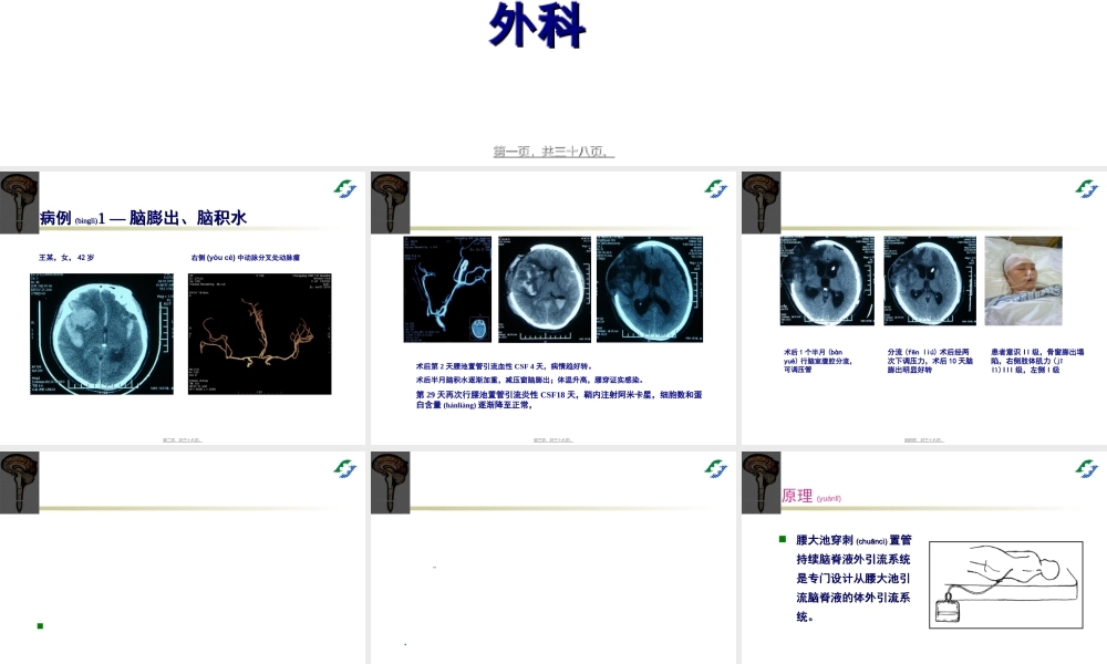 2022年医学专题—腰大池穿刺置管引流术(1).ppt