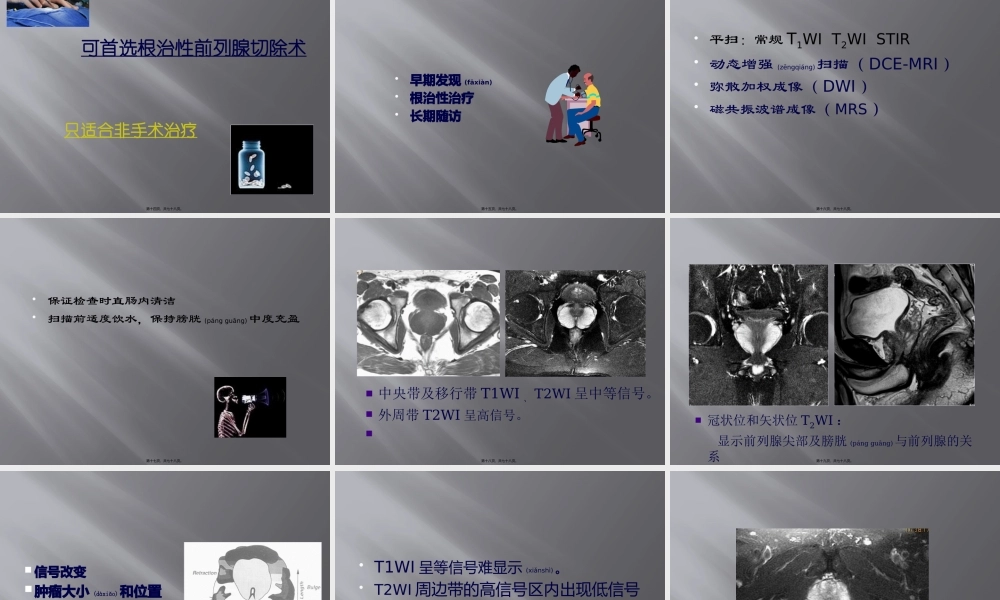 2022年医学专题—腹腔镜下前列腺癌根治术===(1).pptx