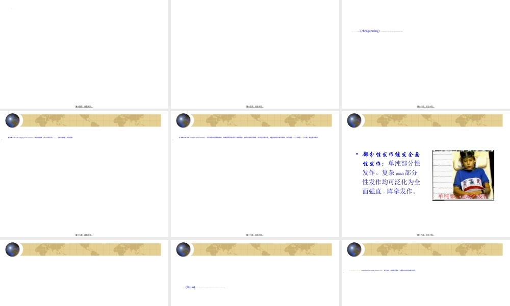 2022年医学专题—GBS和EP、颅内感染解读.ppt