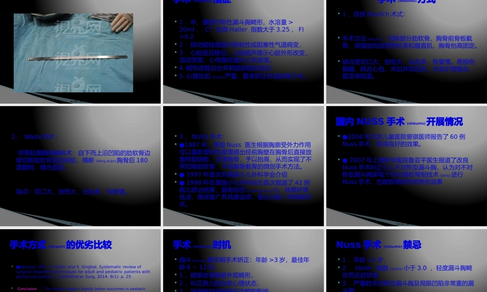 2022年医学专题—NUSS手术.pptx