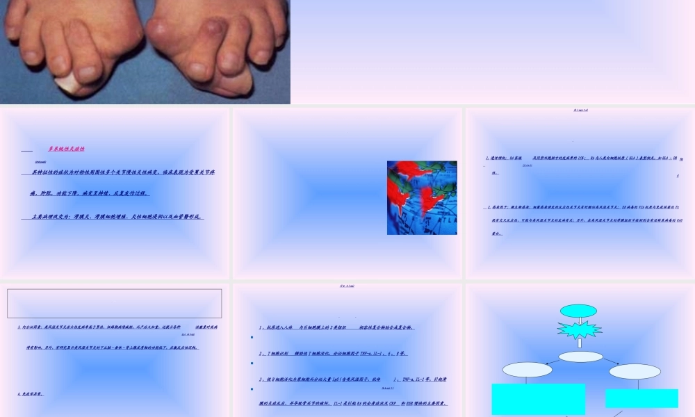 2022年医学专题—中西结合7年制教材(大量图片)类风湿性关节炎.ppt