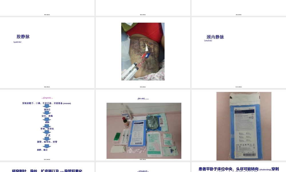 2022年医学专题—临时血液透析导管置管术.ppt