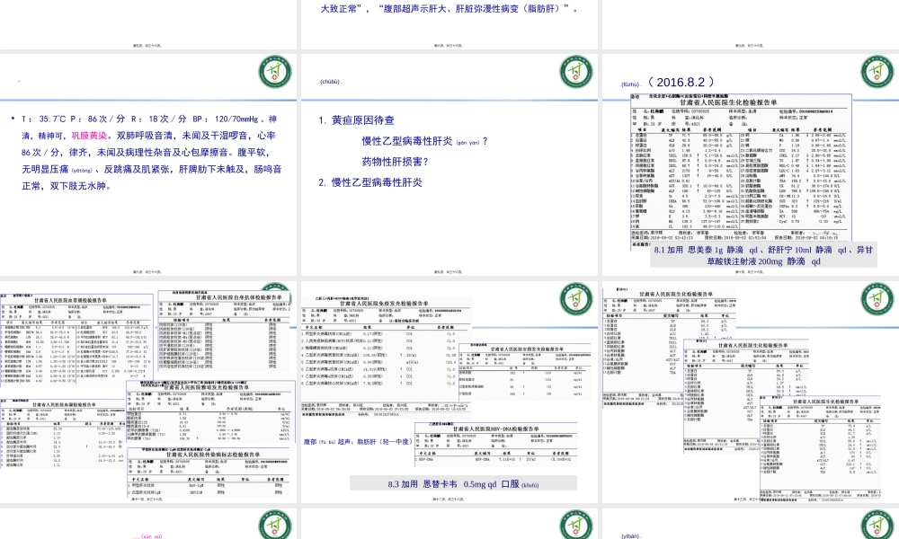 2022年医学专题—乙肝病例分享.ppt