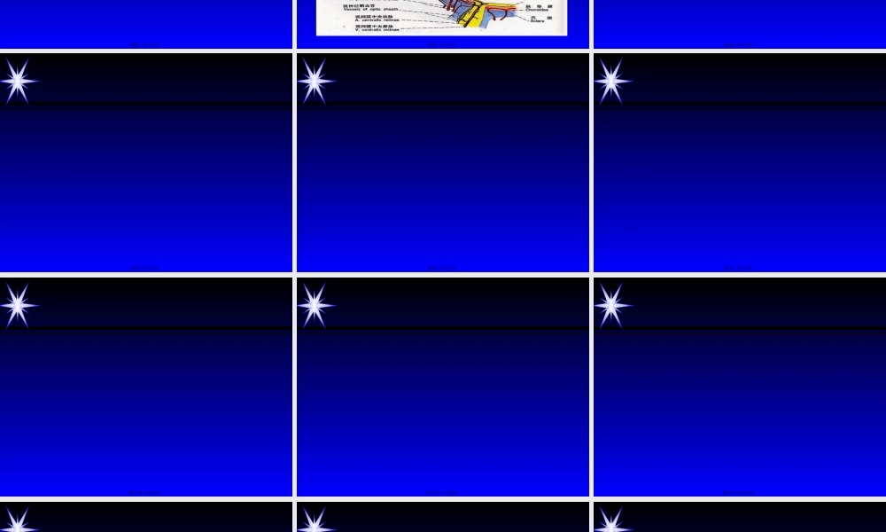 2022年医学专题—俯卧位脊柱手术与视力损害-蒋忠.ppt