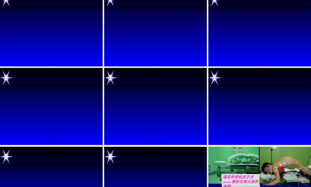 2022年医学专题—俯卧位脊柱手术与视力损害-蒋忠.ppt