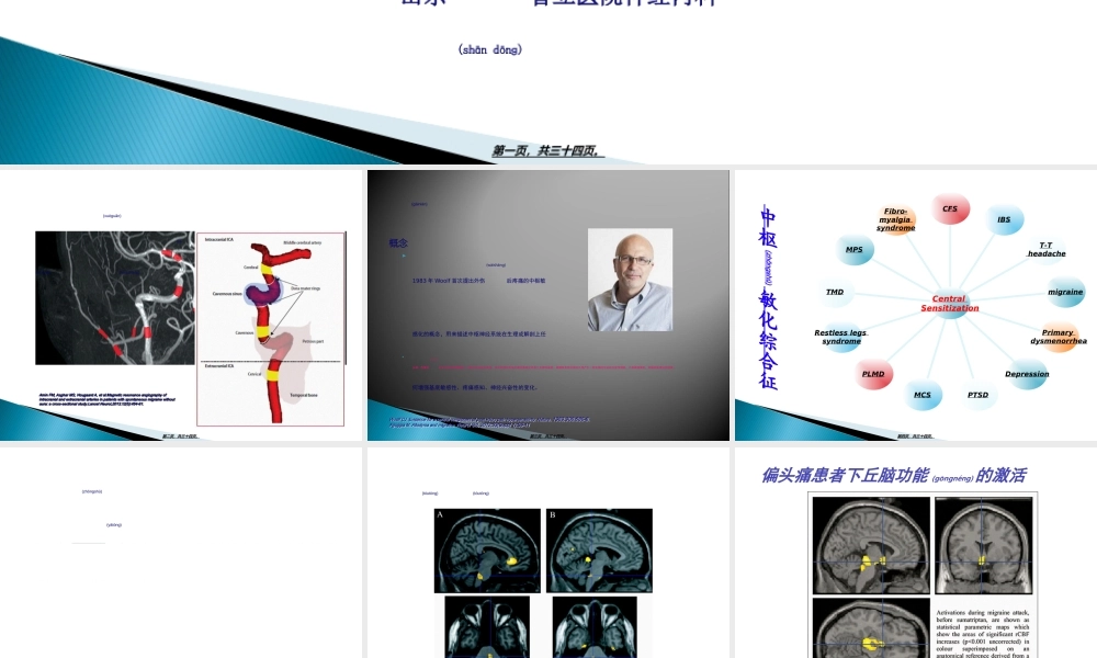 2022年医学专题—偏头痛与中枢敏化--陈春富.ppt