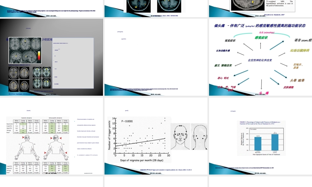 2022年医学专题—偏头痛与中枢敏化--陈春富.ppt