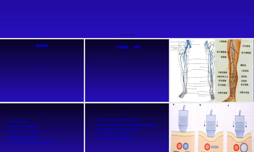 2022年医学专题—刘怡下肢静脉曲张的超声检查.ppt