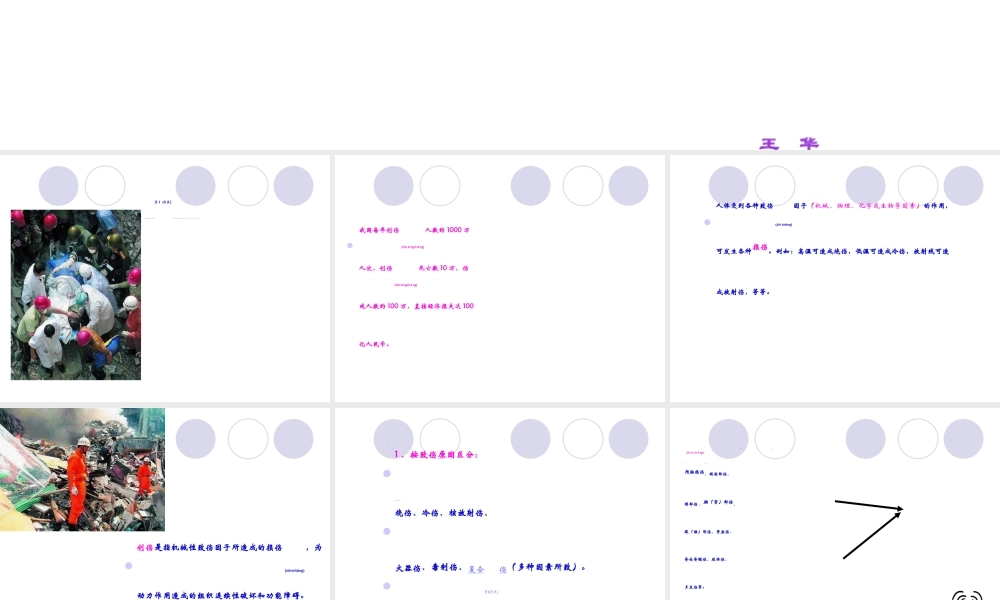 2022年医学专题—创伤概述().ppt