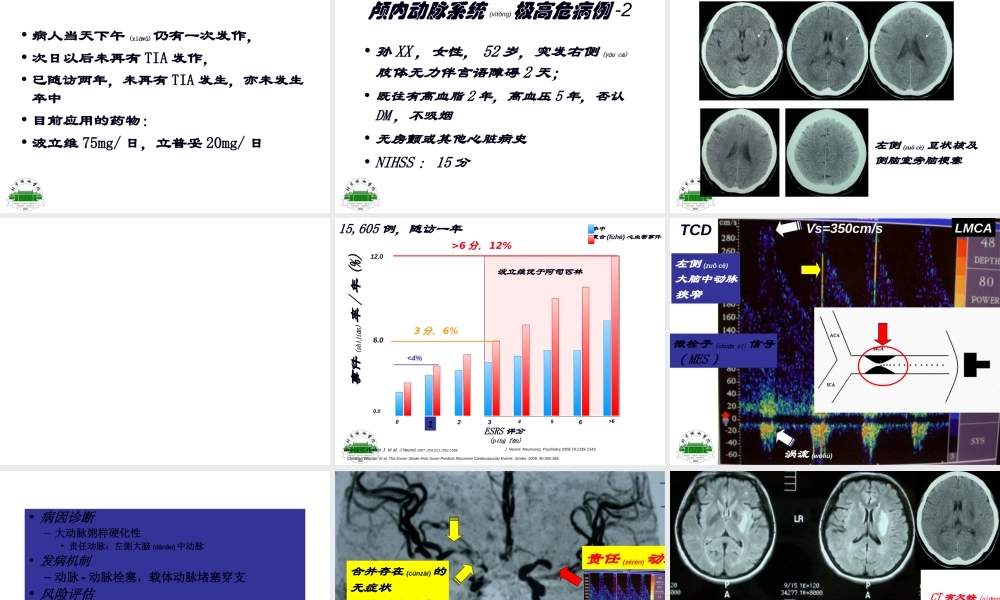 2022年医学专题—动脉粥样硬化性梗死分层病例.ppt