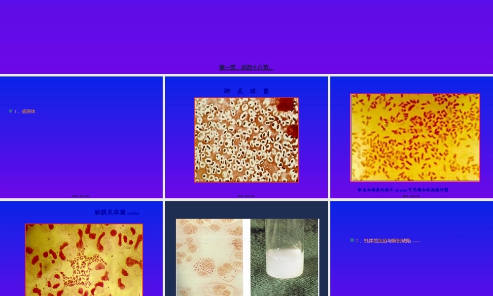 2022年医学专题—化脓性脑膜炎修改-PPT文档资料.ppt