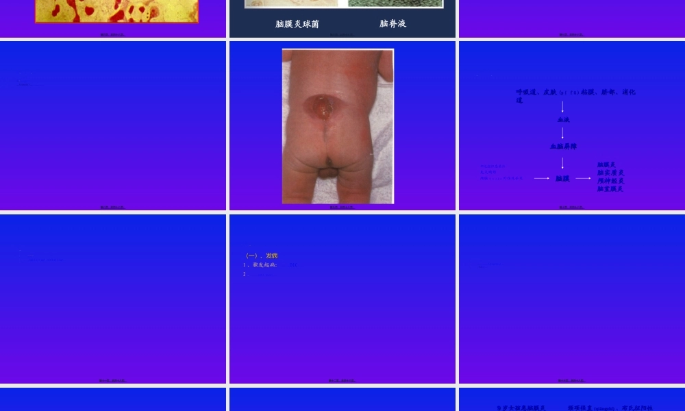 2022年医学专题—化脓性脑膜炎修改-PPT文档资料.ppt