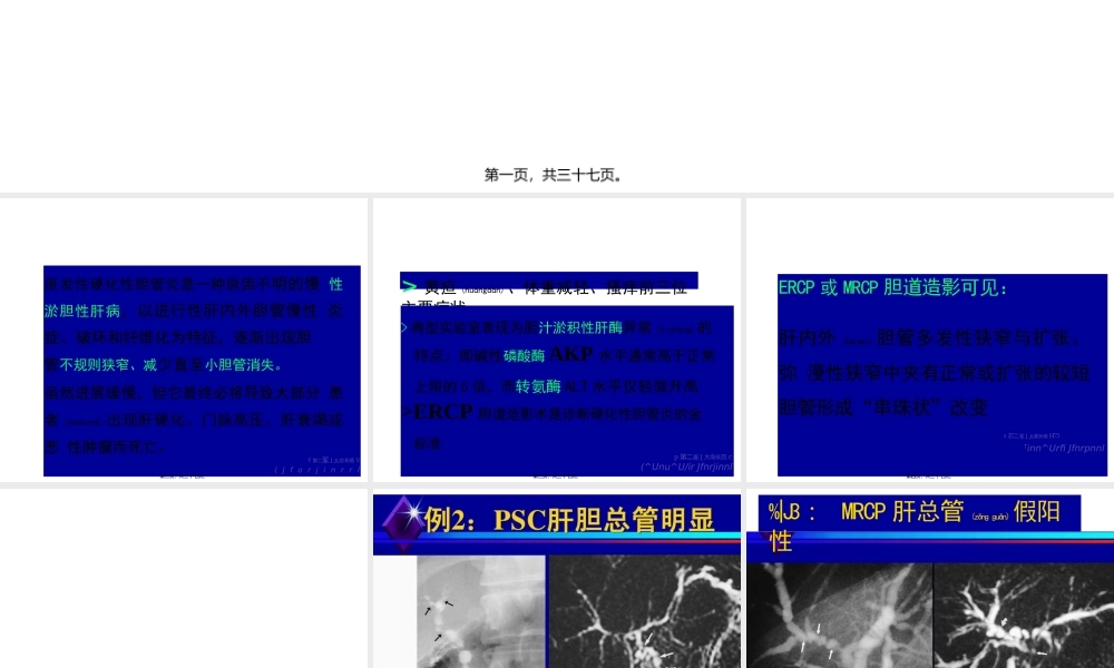 2022年医学专题—原发性硬化性胆管炎.pptx