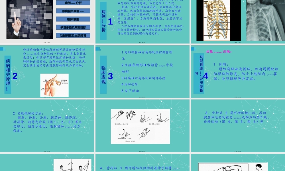 2022年医学专题—右锁骨骨折.ppt