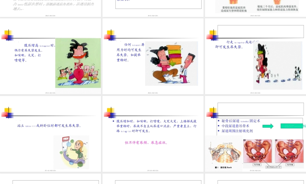 2022年医学专题—各种抗尿失禁术式的特点及复发处理.ppt
