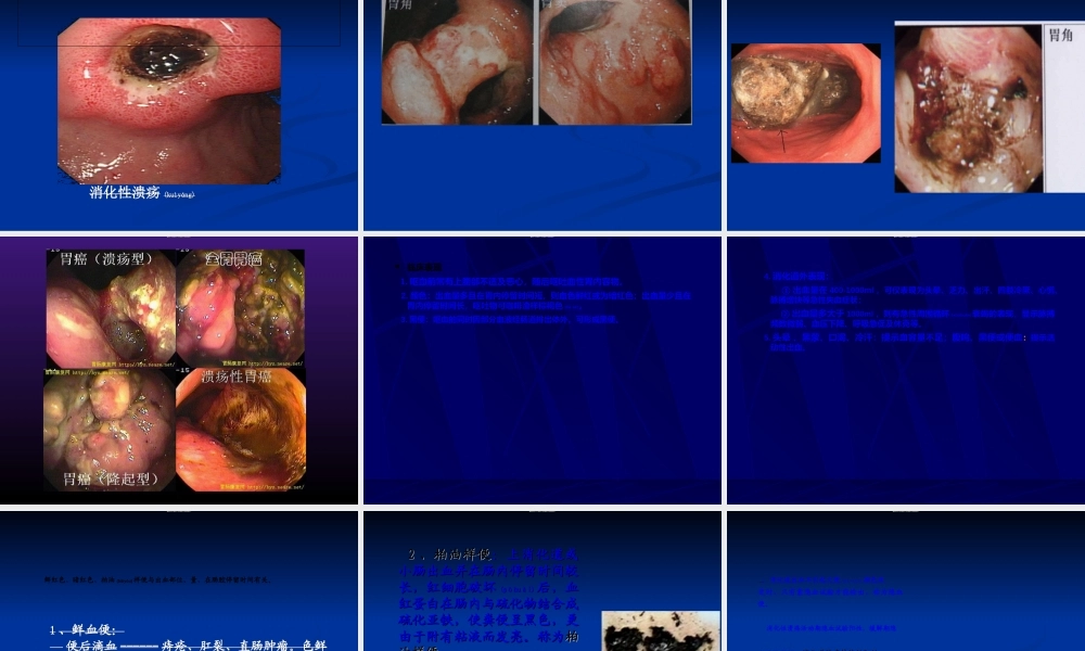 2022年医学专题—呕血与便血-2.ppt