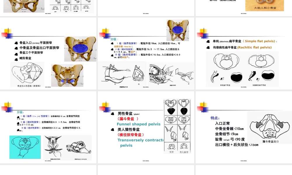 2022年医学专题—坐骨棘间径8cm.ppt