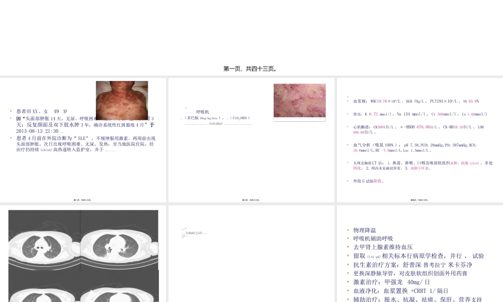 2022年医学专题—复杂感染.ppt