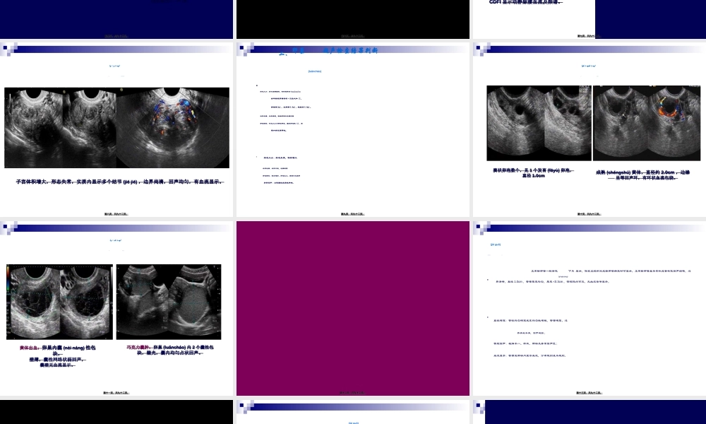 2022年医学专题—妇科超声常规检查风险评估-(NXPowerLite).ppt