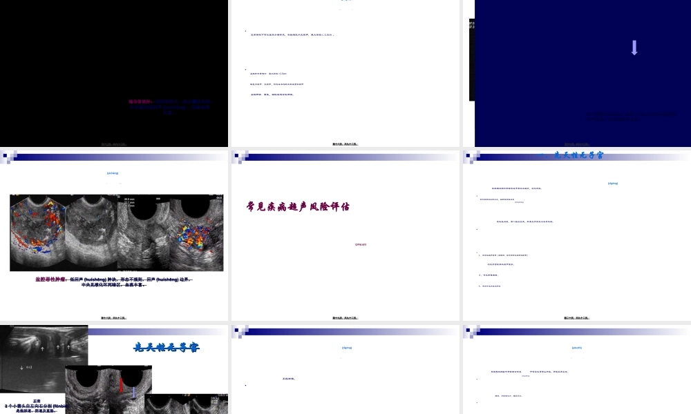 2022年医学专题—妇科超声常规检查风险评估-(NXPowerLite).ppt