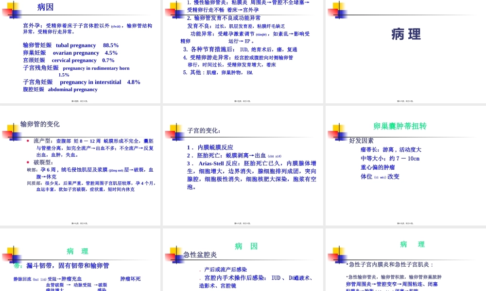 2022年医学专题—妇科急腹症PPT.ppt
