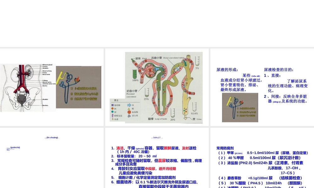 2022年医学专题—尿-液-检-查.ppt
