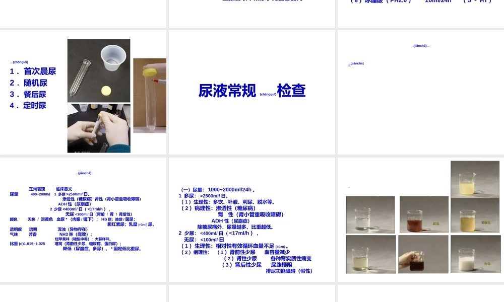 2022年医学专题—尿-液-检-查.ppt