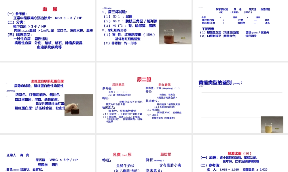 2022年医学专题—尿-液-检-查.ppt