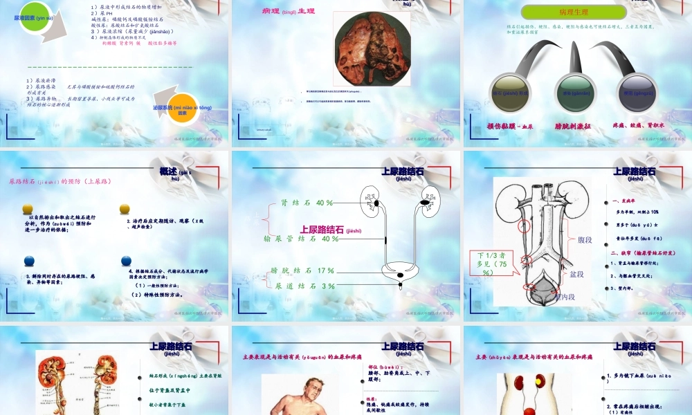 2022年医学专题—尿石症讲稿-庄志明.ppt