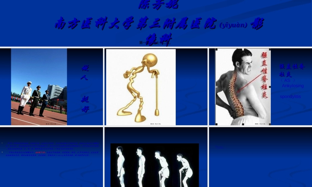 2022年医学专题—强直性脊柱炎早期诊治新进展.ppt