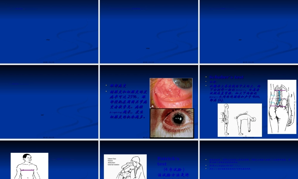 2022年医学专题—强直性脊柱炎早期诊治新进展.ppt