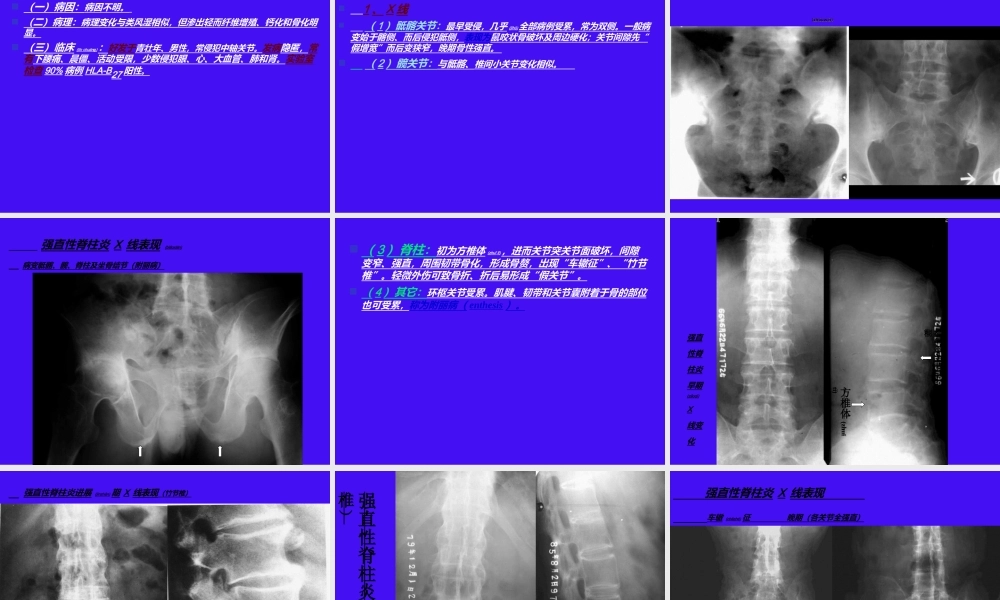 2022年医学专题—影像五年慢性病-骨坏死.ppt