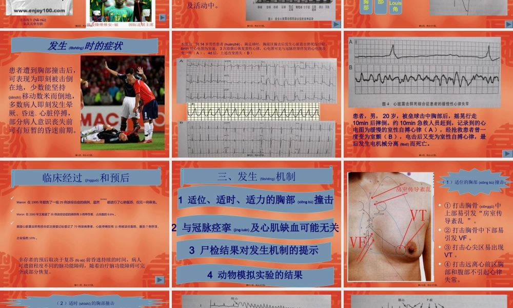 2022年医学专题—心脏震击猝死综合症.ppt