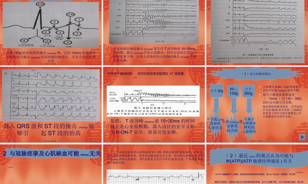 2022年医学专题—心脏震击猝死综合症.ppt