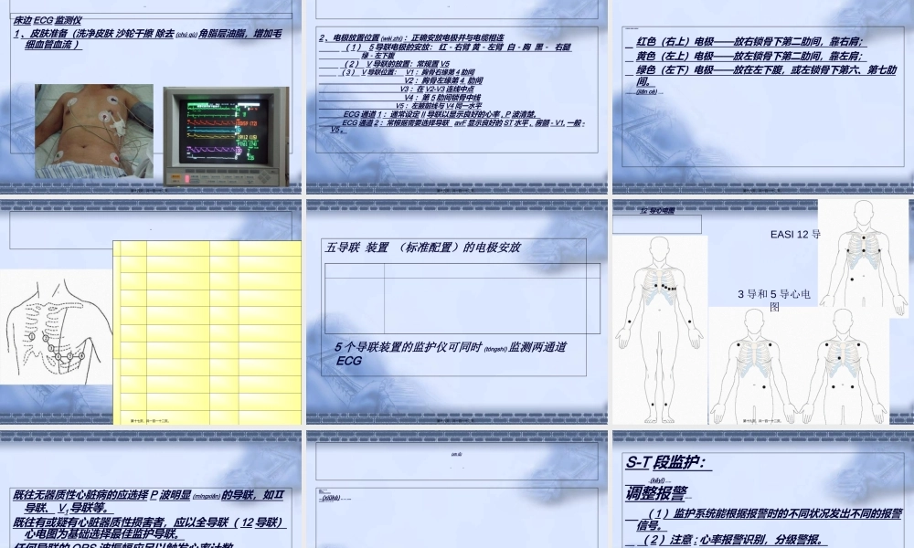 2022年医学专题—危重病人的基本监护技术-PPT文档.ppt