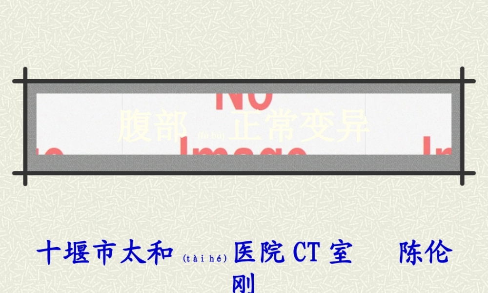 2022年医学专题—腹部变异(1).ppt