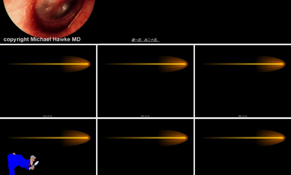 2022年医学专题—急性中耳炎的应急处理方法.ppt