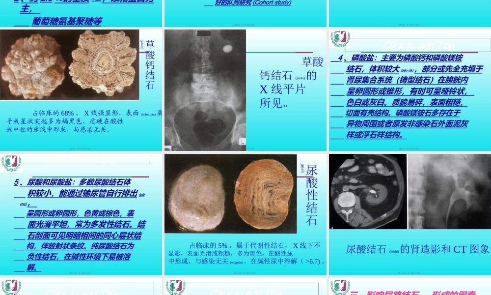2022年医学专题—尿石症(2013)(1).ppt