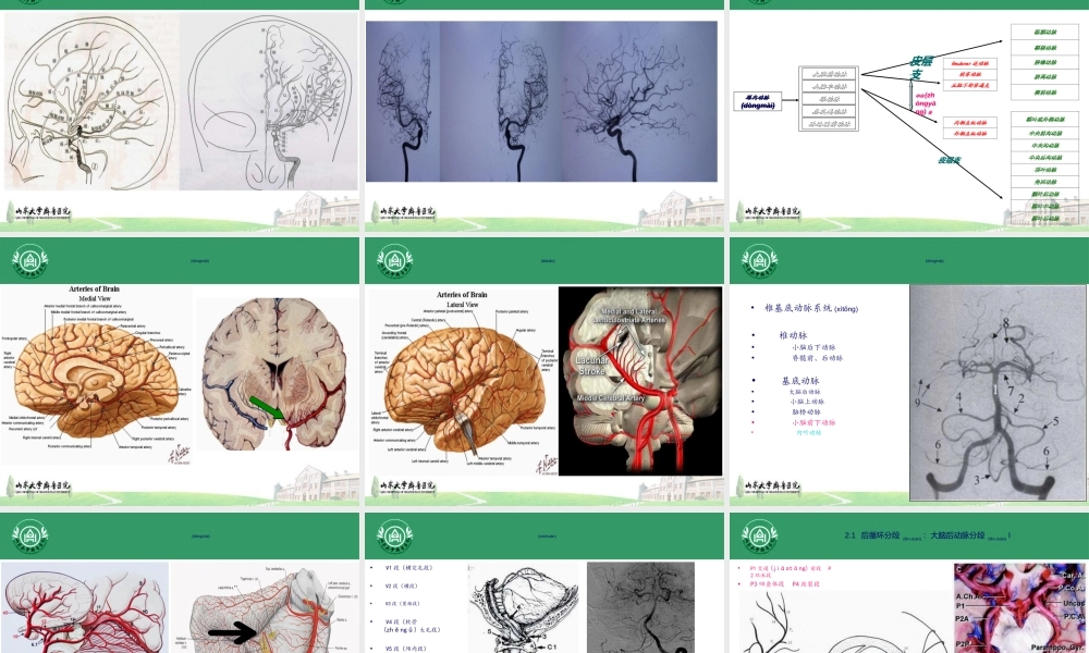 2022年医学专题—穿支动脉梗死(1).ppt