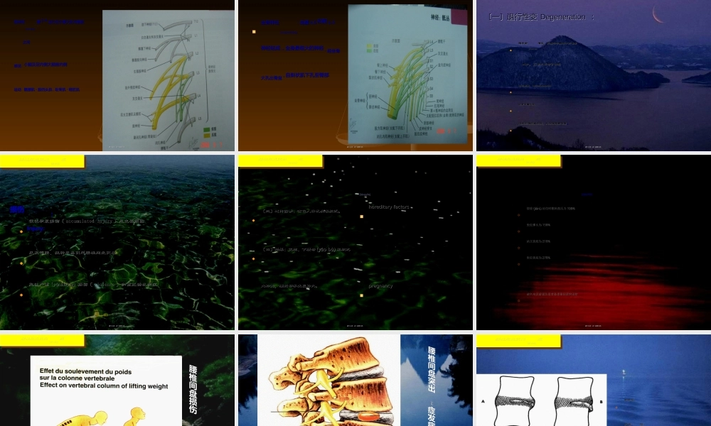2022年医学专题—椎间盘突出症(1).ppt