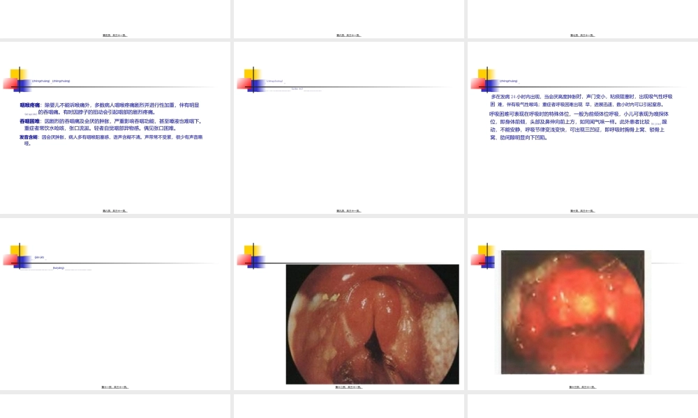 2022年医学专题—急性会厌炎.ppt